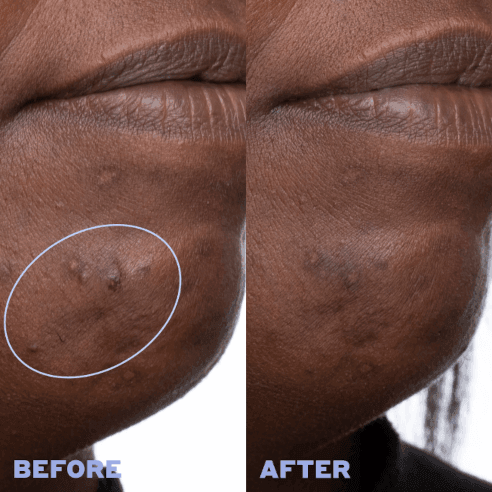before/after