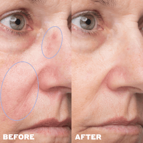 before/after