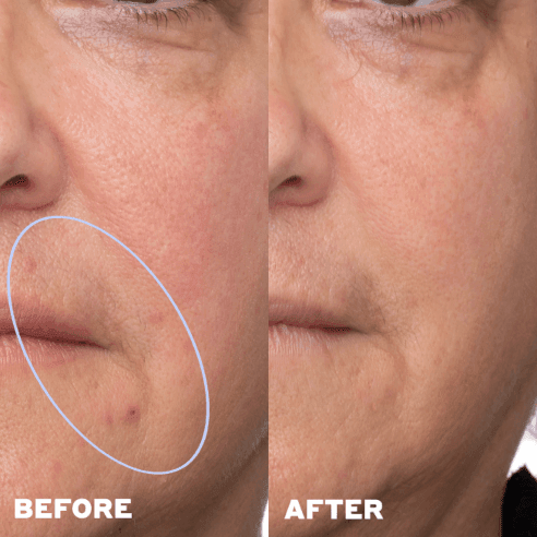 before/after