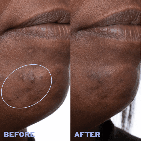 Before and after result 1