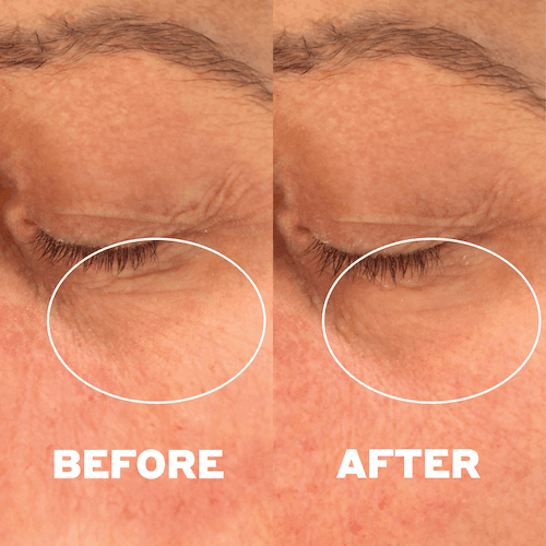 Before and after result